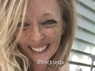Xfreckledx